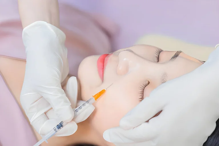 Complete Guide to Cheek Fillers in Cypress