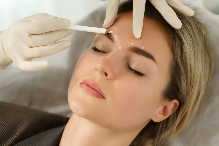 How Long Does Botox Last? Duration and Results 9 Botox Injections Cypress