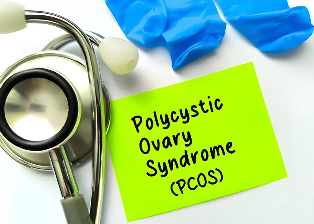 PCOS Symptoms and Treatment: What Every Woman Should Know 1 PCOS Symptoms and Treatment