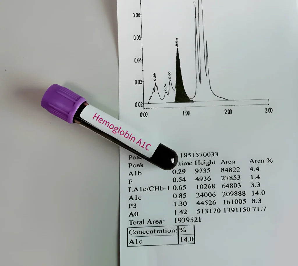 Normal A1C Level by Age