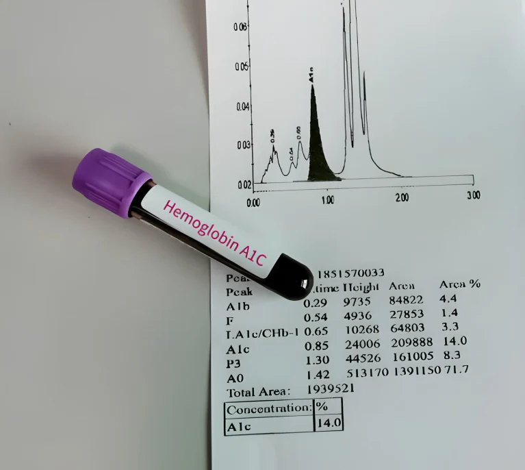 Normal A1C Level by Age
